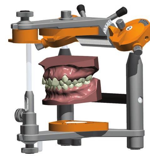 3Shape OrthoAnalyzer Diagnostik und Behandlungsplanung Nutzen Sie die volle Leistungsfähigkeit von 3D für bessere Kieferorthopädie Legen Sie fest und vervollständigen Sie präzise Falldiagnostik und