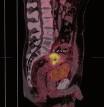 Die hochauflösende PET/CT im DTZ ist in der Lage, innerhalb von 10 12 min den gesamten Körper auf bösartige Prozesse zu untersuchen.