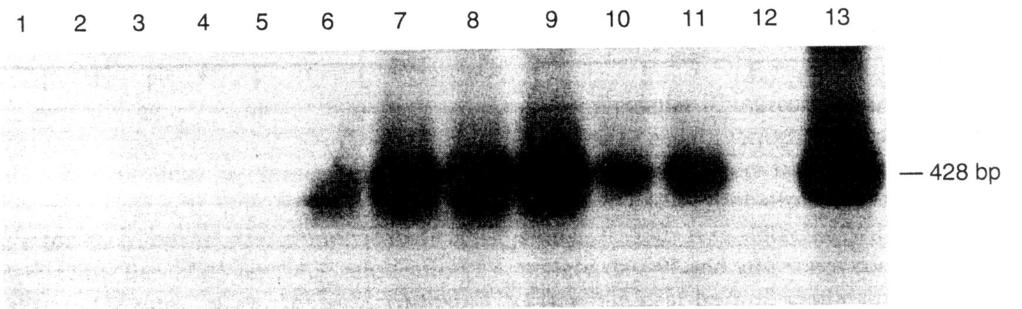 4.1.1.2.3. Ovar In ovariellen Follikeln verschiedener Größen sowie in Corpora albicantia der zyklischen Stute konnte mit RT-PCR keine Relaxin-mRNA nachgewiesen werden.