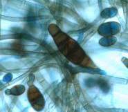 Schimmelpilzallergien Wachstum und Ernährung auf organischem Material Heterotrophe Organismen Aus Sporen bilden sich Myzellen An deren Spitzen wachsen Pilzfäden (Hyphen) Schadensbildung Lebensmittel,