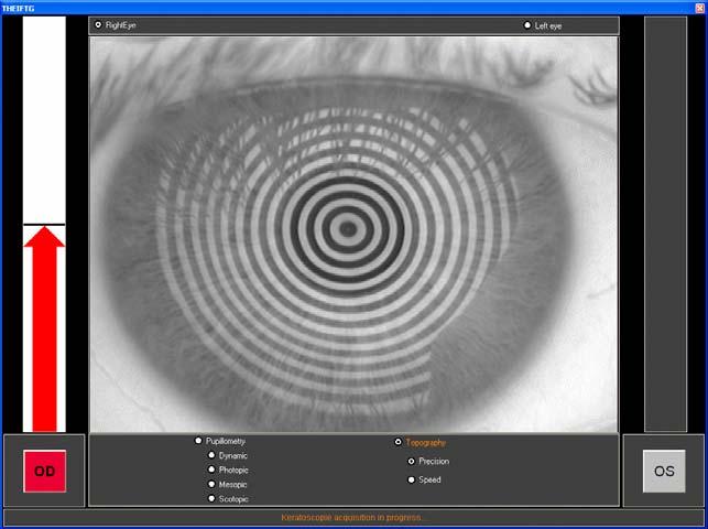 Aufnahme rechtes Auge Aufnahme linkes Auge Live-Bild Untersuchungsauswahl Topographie - Automatische