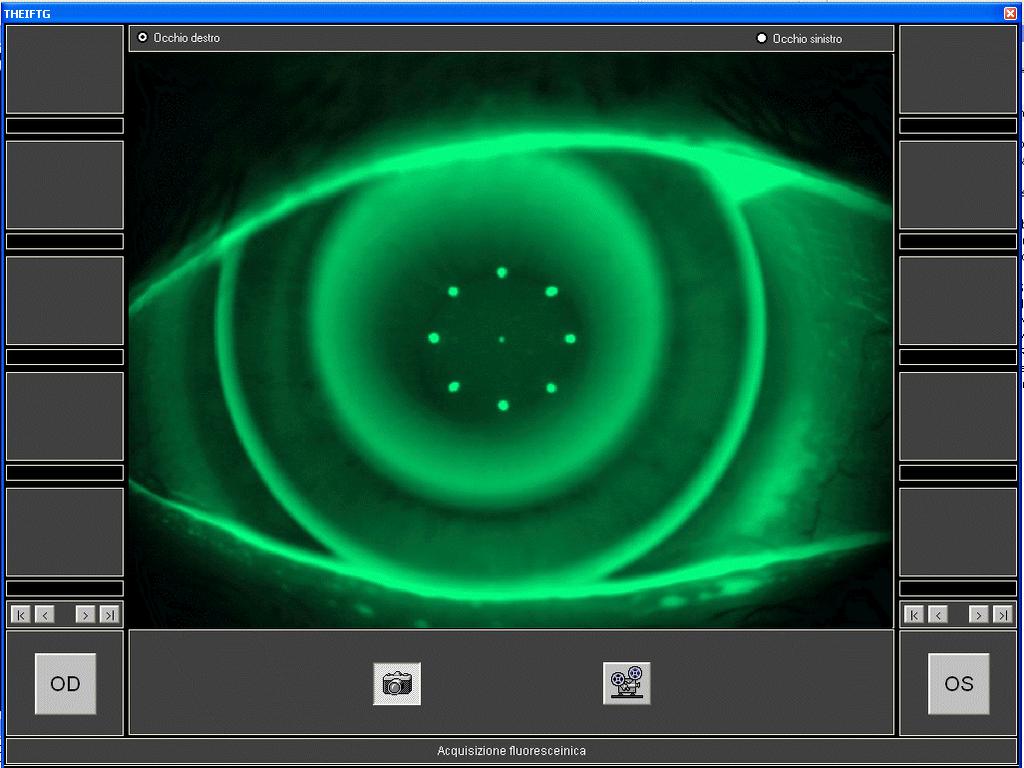 Fluoreszenz-Aufnahme: Galerie für rechtes Auge Galerie für linkes