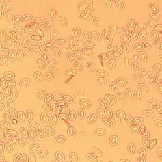 19: Wirkung sezernierter Bakterienproteine auf RTG-2-Zellen (links) bzw. Forellenerythrozyten (rechts).