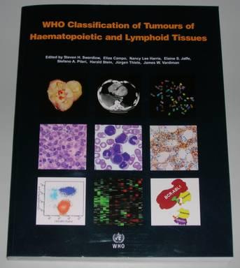 Klassifikation der Lymphome (WHO 2008) Reife B-Zell Neoplasien Chronische lymphatische Leukämie / kleinzelliges Iymphozytisches Lymphom B-Zell Prolymphozytenleukämie Splenisches