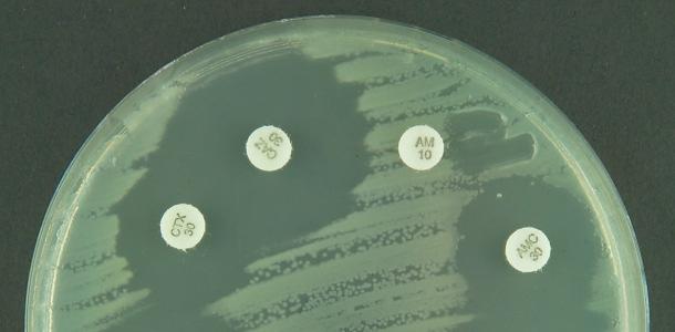 ESBL-bildende Enterobakterien Betalactamasen sind von Bakterien gebildete Enzyme, die verschiedene Betalactam- Antibiotika zerstören können.