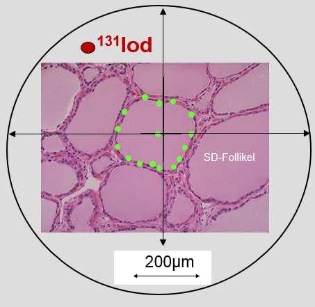 β-strahlung Schilddrüse Magen