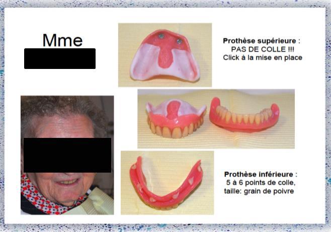 4. Tipps und Tricks Prothesenhygiene Protokoll und schriftliches Vorgehen: schriftliche Mundhygieneverordnung