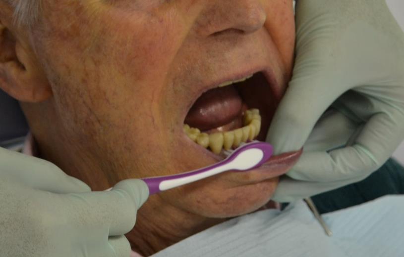 5. Pflegefall: mittlere Abhängigkeit Einwohner, der sich nicht selber die Zähne putzen kann, aber sie sich putzen lässt : vorsichtig mit Zahnbürste und «eigener Technik» putzen sich hinter den