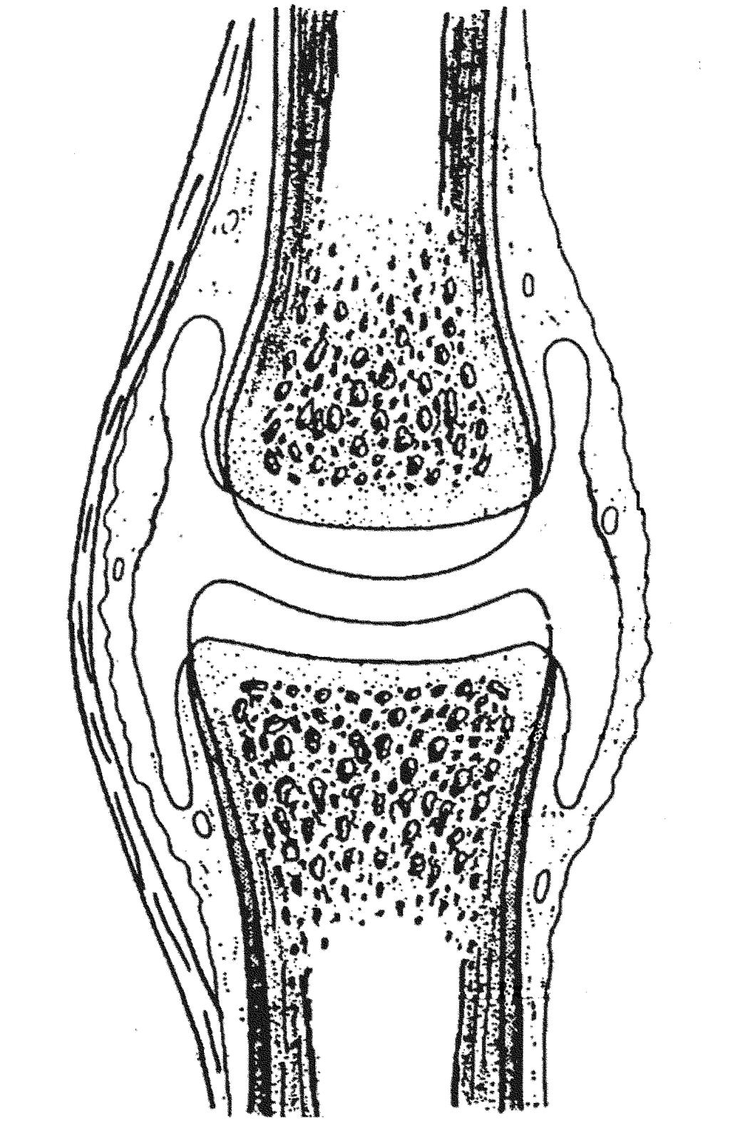 synoviale Stratum fibrosum Gelenkkapsel Gelenkhöhle Gelenkknorpel Knochen