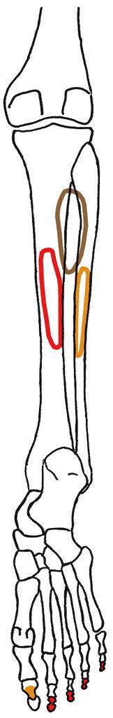 Dorsale extrinsische Fussmuskeln extrinsisch = lang: Ursprung am Unterschenkel, Ansatz am Fuss M. triceps surae (siehe auch Kniegelenk) S M. soleus: Soleusarkade alcaneus (tiefer Kopf) M.