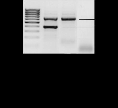 Abbildung 12: Beispiel eines Agarosegels zur R26 Genotypisierung.