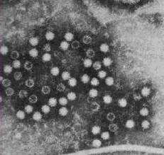 Das Hepatitisviren-ABC Hepatitis A Anti-HEV;