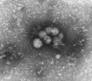 Das Hepatitisviren-ABC Hepatitis A Anti-HCV;