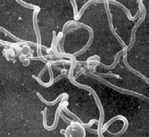 Infizierung Der Erreger der Borreliose ist ein Bakterium der Gattung Borrelia, das zur Gruppe der Spirochäten gehört. Unter Spirochäten werden spiralförmige, sich aktiv bewegende Bakterien verstanden.