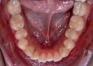 parodontologischen Abteilung ein entzündungsfreies und ausreichend konservierend versorgtes Gebiss.