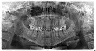 Planung der Zahnbewegung maßgeblichen Einfluss auf das Ergebnis [Simon et al., 2014].