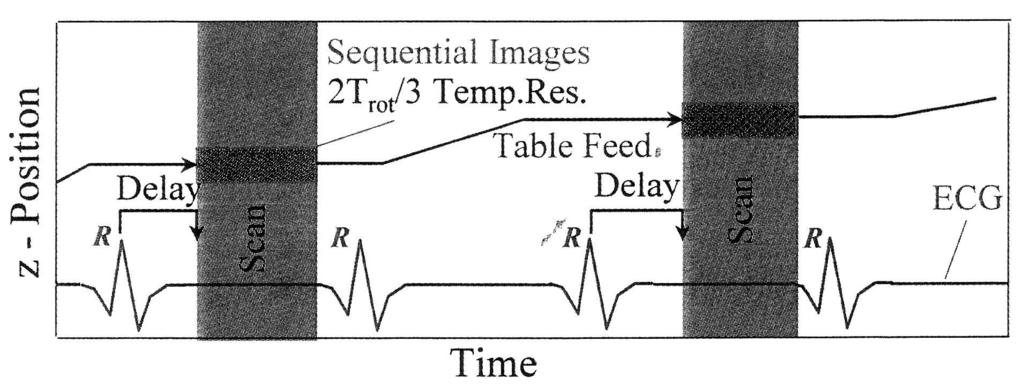 Abb. 4: schematische Darstellung der prospektiven EKG-Triggerung aus Ohnesorge et al. [92].