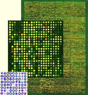BI-Felder Expressionsdatenanalyse Mit Microarrays la ßt sich messen, wie