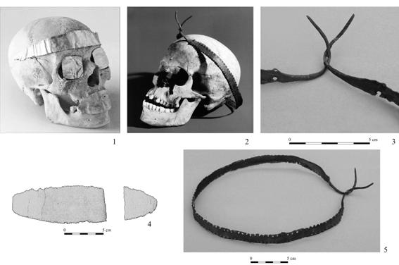 THE VÖRS DIADEM: A UNIQUE RELIC OF LATE COPPER AGE 107 fig. 4. 1. Kültepe (after Kulakoğlu Kangal 2010 cat. nos 319 321) 2. the skull with the diadem, 3, 5.
