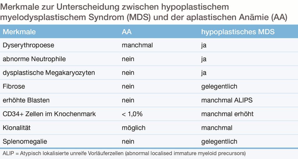 Tab. 1: Merkmale zur Unterscheidung zwischen hypoplastischem myelodysplastischem Syndrom (MDS) und der aplastischen Anämie (AA) (modifiziert nach [16], Daten aus [17, 18, 19]) Prof.