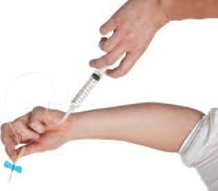 Befestigen Sie das Venenpunktionsbesteck an der Injektionsspritze mit dem aufgelösten CINRYZE. 3.