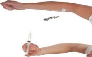 Um zu vermeiden, dass sich die Nadel während der Injektion verschiebt, kleben Sie die Flügelkanüle mit medizinischem Tape an Ihrer Haut fest.