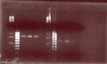Ergebnisse 42 verwendet. Die Amplifizierung der DNA mit Hilfe des jeweiligen Primerpaares erfolgte unter identischen PCR-Bedingungen.