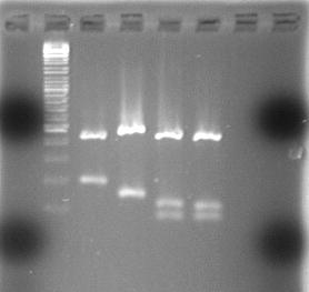 Ergebnisse 73 und 96 bp. Im Gegensatz dazu liegt die Größe der DNA-Fragmente des C. lusitaniae Stammes DSM 70102 bei etwa 470 und 125 bp. Wie in Abb. 3-27 (S.