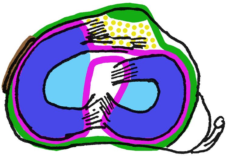 Transversalschnitt des Kniegelenks orm der Menisken Innenmeniskus sichelförmig, schlecht schwenkbar Aussenmemiskus geschlossene -orm, gut schwenkbar Querschnitt keilförmig: kapselseitig dick, zentral