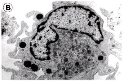 Abfangen von Antigen Einleitung Immunantwort A = Interdigitierende Zelle Große