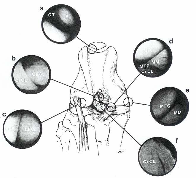 Literaturübersicht Abbildung 3: arthroskopisch sichtbare Strukturen im Kniegelenk des Hundes bei kranialer Aufsicht in Anlehnung an PERSON (1985) a: Patella (P), distaler Anteil des geraden