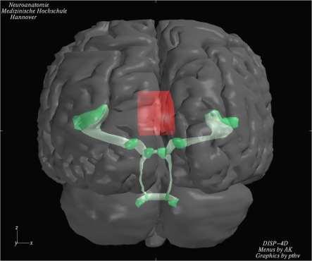 Diagnostik Binaurale Tests, objektiv Colliculus inferior: Binaurales