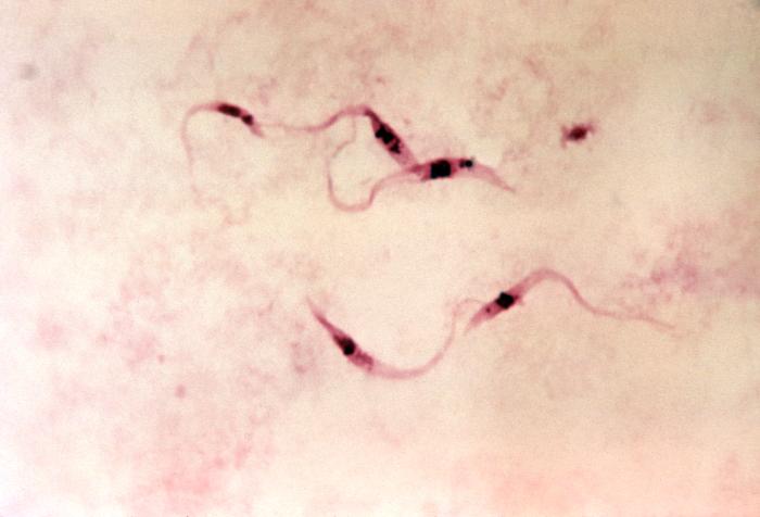 CDC 7 Chagas-Krankheit Die Chagas-Krankheit, auch amerikanische Trypanosomiasis genannt, wird durch den einzelligen Parasiten Trypanosoma cruzi hervorgerufen.
