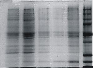 Kapitel 3: Vorversuche zur Identifizierung des Uracil-bindenden Proteins 157 Sucrose 41 % 29 % F5 F4 F3 F2 F1 SM 250 150 100 75 50 37 25 20 Abb. 3.14: 10 % SDS-PAGE der Sucrosegradientenfraktionen mit einer Rattenhirn- Striatum-Membranpräparation.
