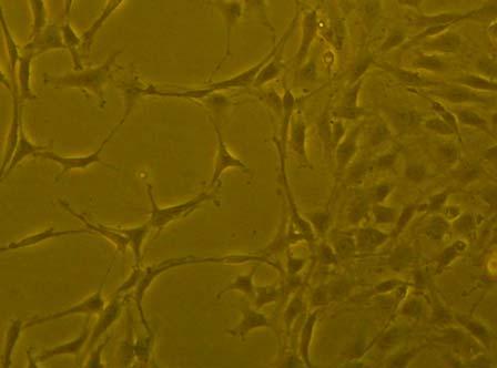 sie typischen länglichen Form, C6-Gliom-Zellen