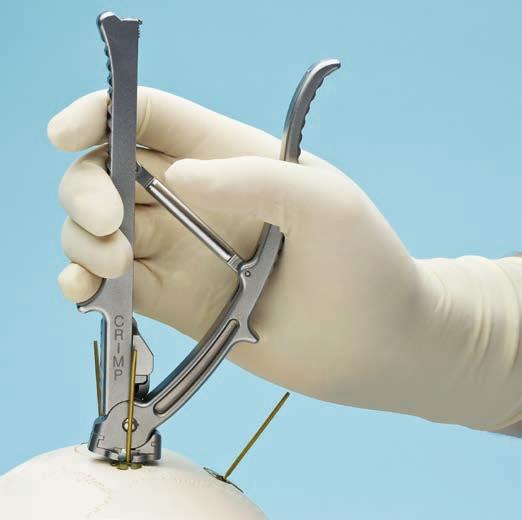 5 Implantate vorkrimpen Instrument 329.