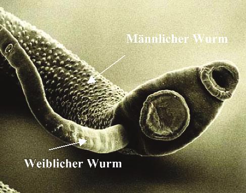 den Antigene. Es kann zu akuten Symp - tomen wie Fieber, Hautausschlägen und Husten kommen, die nach einigen Tagen wieder abklingen.