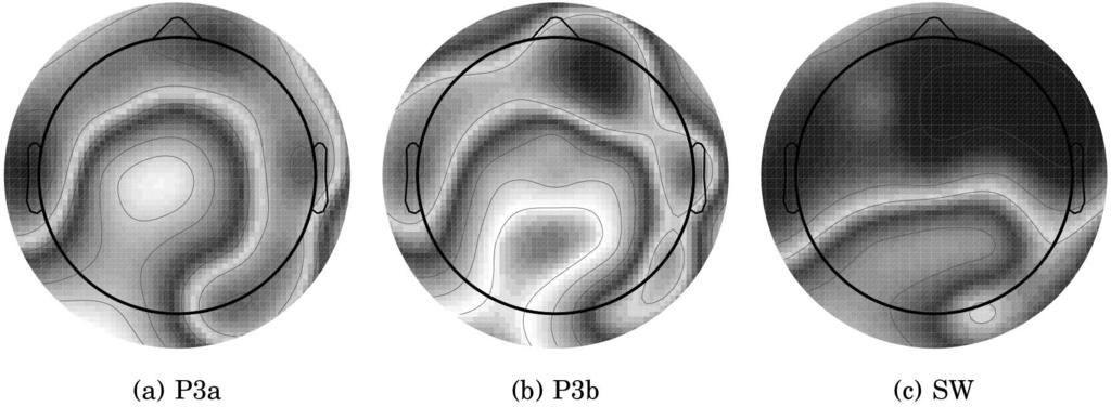 Abbildung 6: Auf den menschlichen Schädel projizierte Evidenz für neuronale Korrelate von auf dem Satz von Bayes basierenden Wahrscheinlichkeitsverteilungen (Gesicht oben, Ohren rechts/links) EKPs