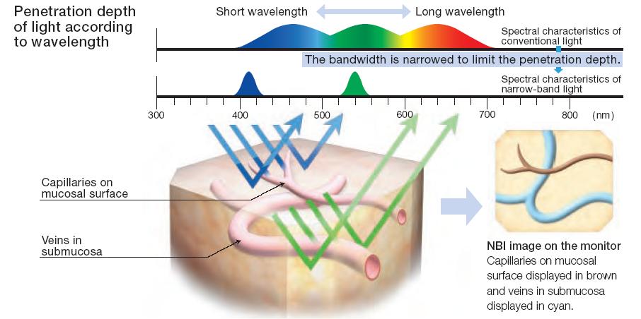 Unterscheidung der Gefäße von Mukosa und Submukosa möglich Eindringtiefe des Lichtes in Abhängigkeit der Wellenlänge kurzwellig langwellig Weißlicht- Endoskopie NBI- Spektrum