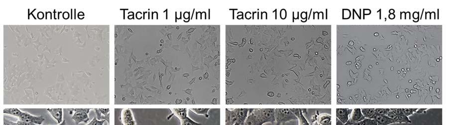 Anhang Abbildung 53: Aufnahmen der mit Tacrin, 2,4-Dinitrophenol (DNP) und Ethdium-Bromid (EtBr) nach Kap. 3.2.9.3 inkubierten Zellen zur Generierung von Rho0-Zellen aus MCF-7-Zellen.