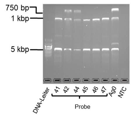 Anhang Abbildung 68: Gelelektrophoretische Auftrennung (Kap. 3.2.6) der PCR-Produkte der PCR zur Zusammenführung der GSTM1- und GSTT1-Genotypisierung nach Kap. 3.2.10.2. Templat: DNA aus Humanproben und Humanzellinien (Kap.