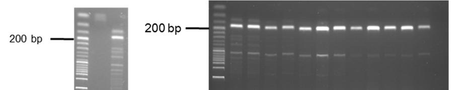 Anhang Abbildung 70: Gelelektrophoretische Auftrennung (Kap. 3.2.6) der PCR-Produkte der PCR der Positivkontrollenverifizierung des GSTP1-Polymorphismus mittels RFLP-PCR nach Kap. 3.2.10.4.