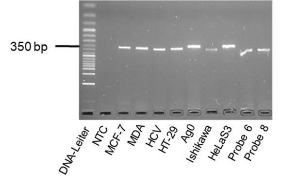 Anhang Abbildung 72: Gelelektrophoretische Auftrennung (Kap. 3.2.6) der PCR-Produkte der PCR zur Positivkontrollenverifizierung des NQO1-Polymorphismus mittels RFLP-PCR nach Kap. 3.2.10.4.