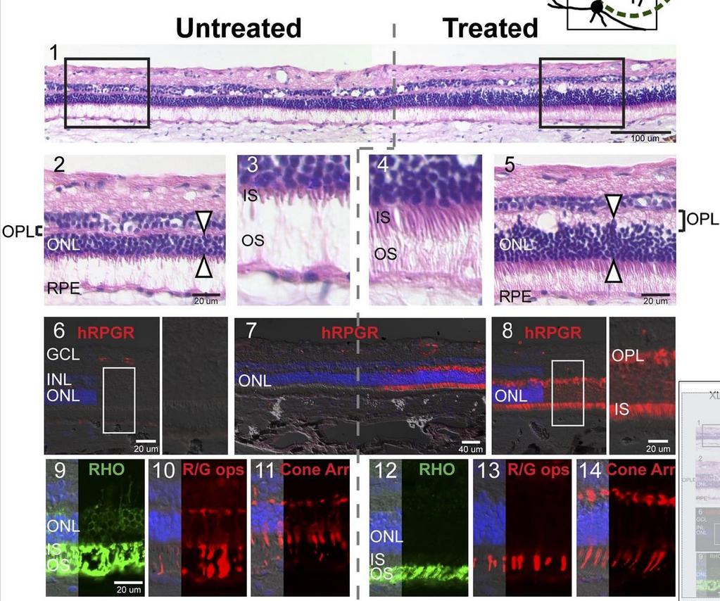 Gene therapy rescues photoreceptor blindness in dogs and paves the way for treating human X-linked retinitis pigmentosa Beltran et al.