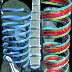 Bildgebende Verfahren Multi - Slice - CT Spiral - CT