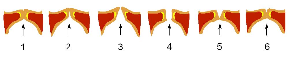 Arten der Anregung des Sprechtrakts (2/2) Stimmhafte Anregung der Stimmbänder (Phonation): Druckabfall