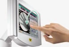 Das Ziehm SmartEye bietet eine komfortable Darstellung des aktuellen Röntgenbilds. Über SmartControl sind alle Funktionen direkt anwählbar.