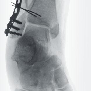 Bildkontrast Zur Beurteilung der Lage des Implantats benötigt man eine klare Darstellung der angrenzenden Anatomie.