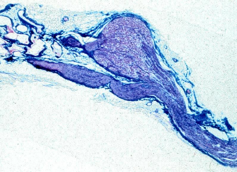 descendierende Bahnen aus Hypothalamus, Pons, Medulla Innervation der Niere Spinalganglienzellen T11-L2, CGRP/SP