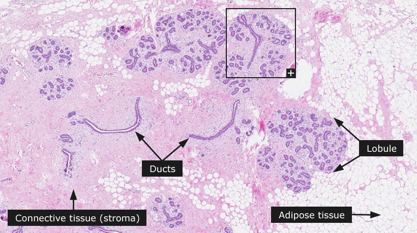 Histologie der Brust TDLE: terminale duktulobuläre